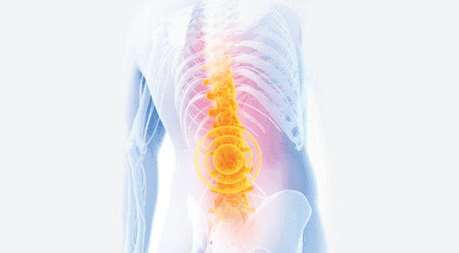 Causes of Back Pain